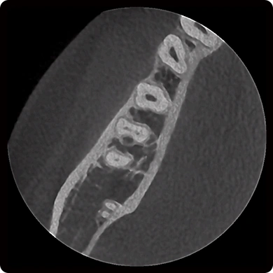CBCT D50