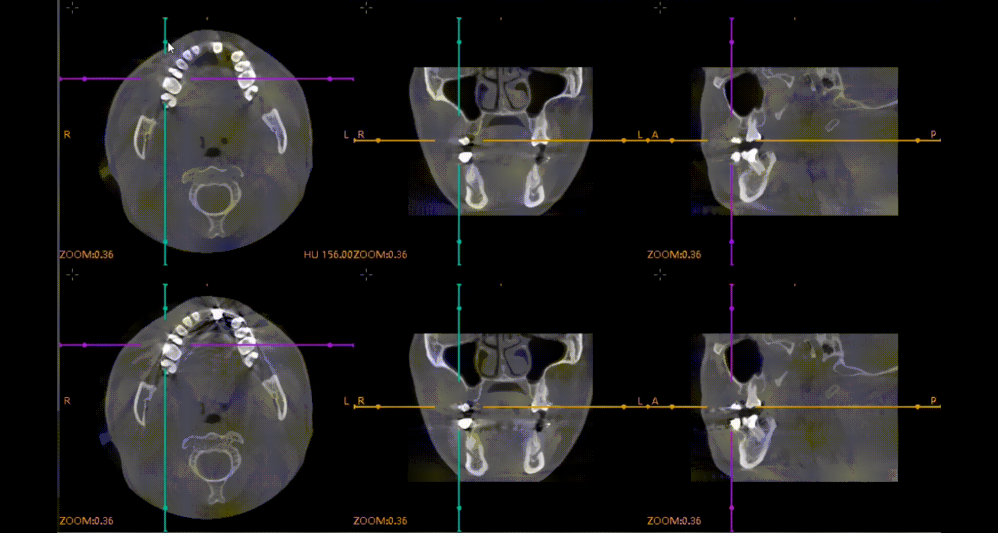 CBCT D50