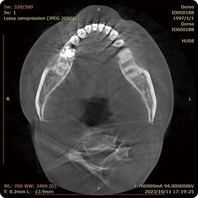 CBCT D50
