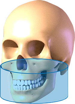 CBCT D50