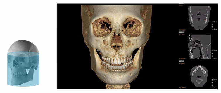 CBCT Series Rubik