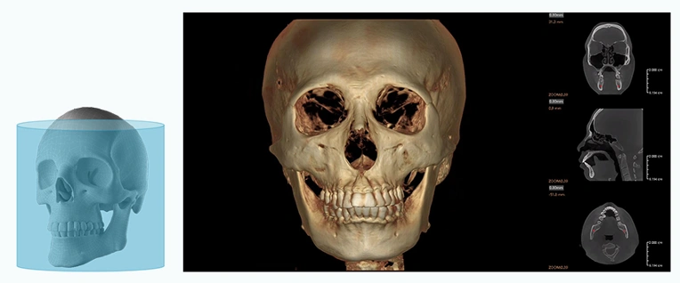 CBCT Series Rubik