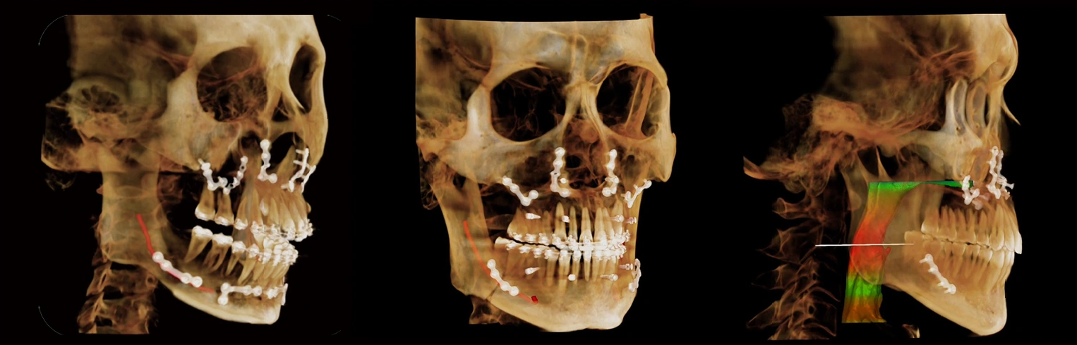 CBCT Series Rubik