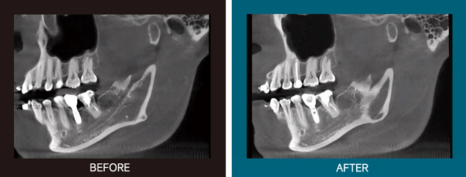 CBCT Series Rubik