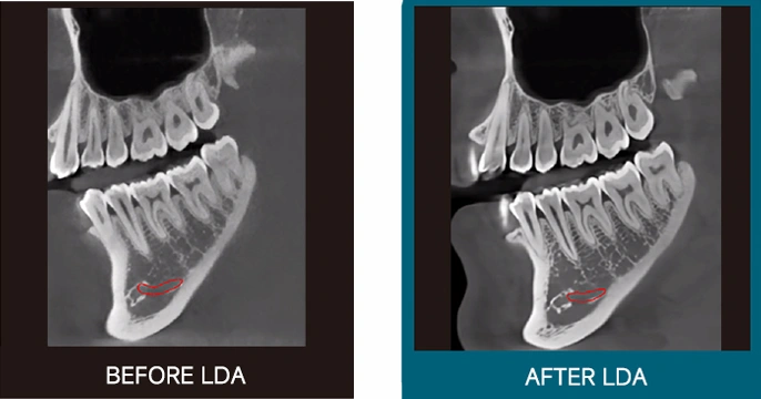 CBCT Series Rubik