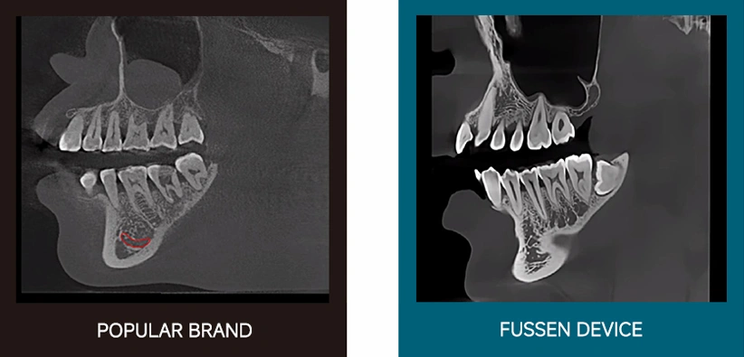 CBCT Series Rubik