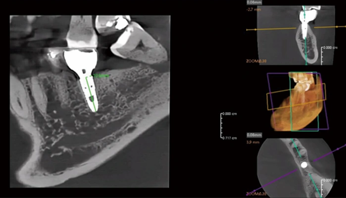 CBCT Series Rubik