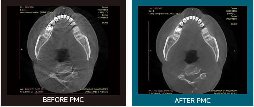 CBCT Series Rubik