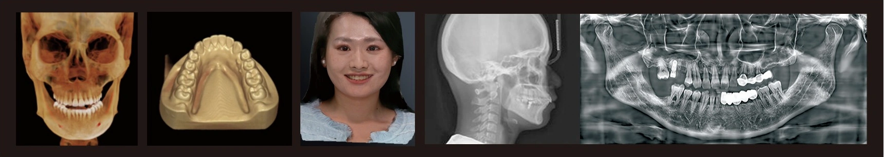 CBCT Series Rubik