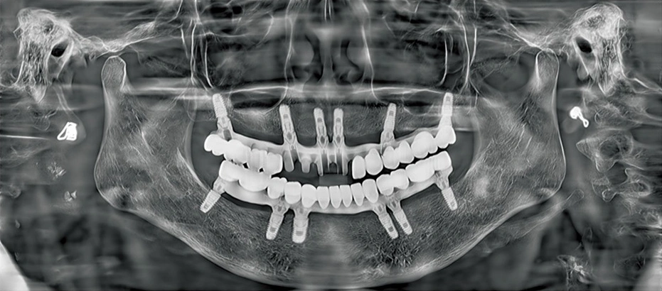 CBCT Series Rubik