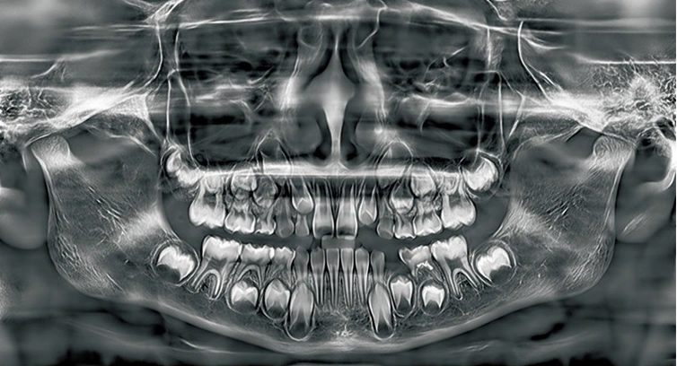 CBCT Series Rubik