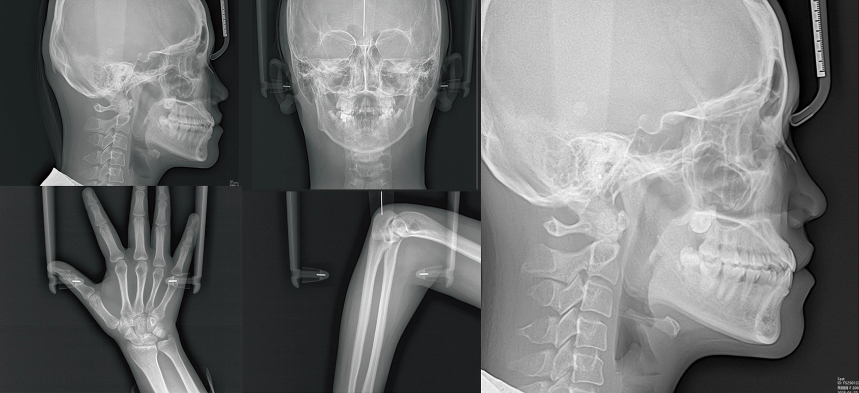 CBCT Series Rubik