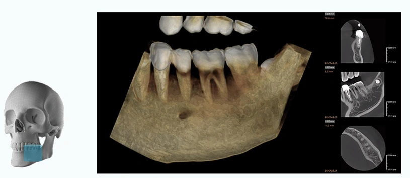 CBCT Series Rubik