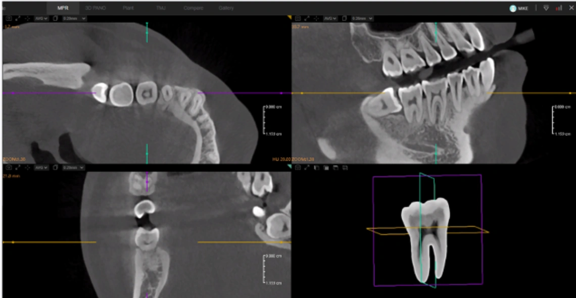 Mostra dentes individualmente