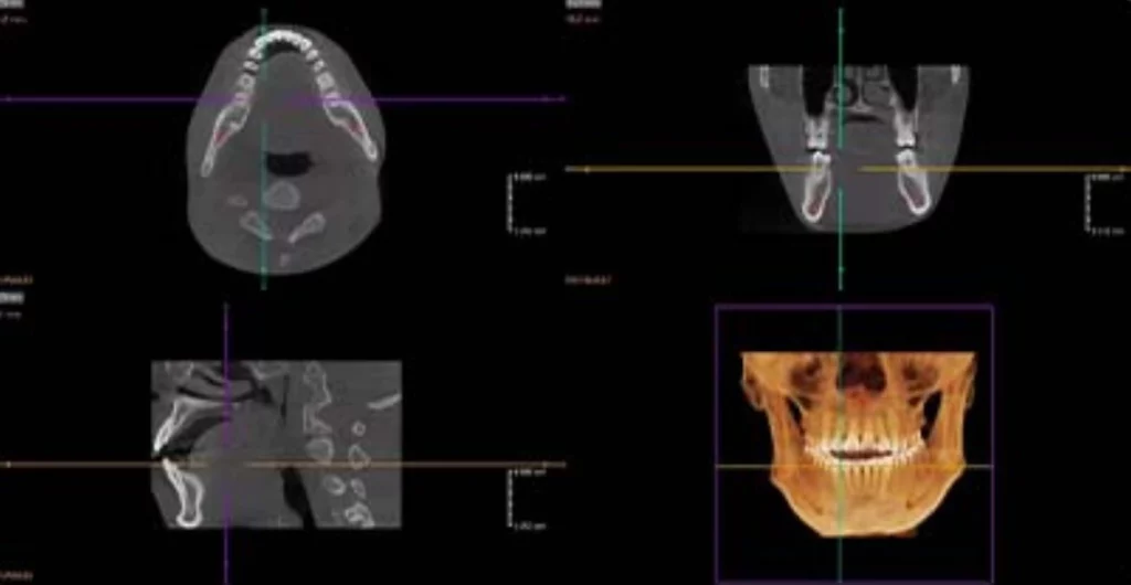 Software Dentário Dental X
