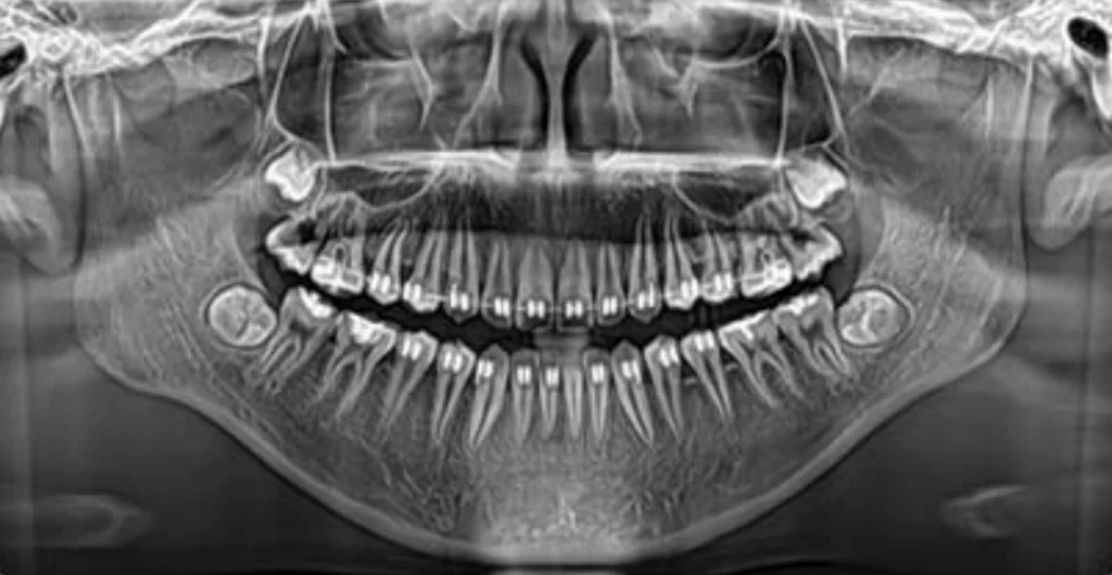 Software Dentário Dental X