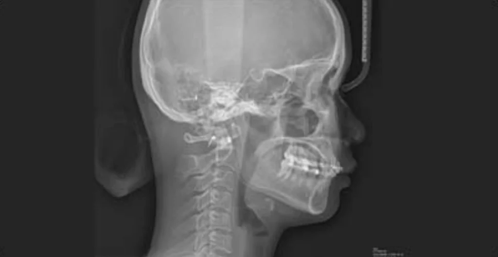 Software Dentário Dental X