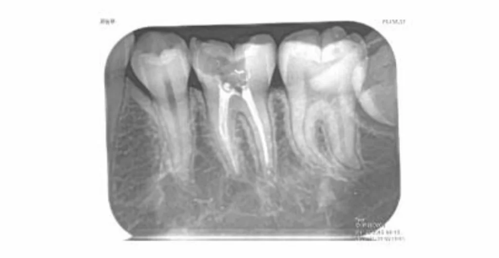 Software Dentário Dental X